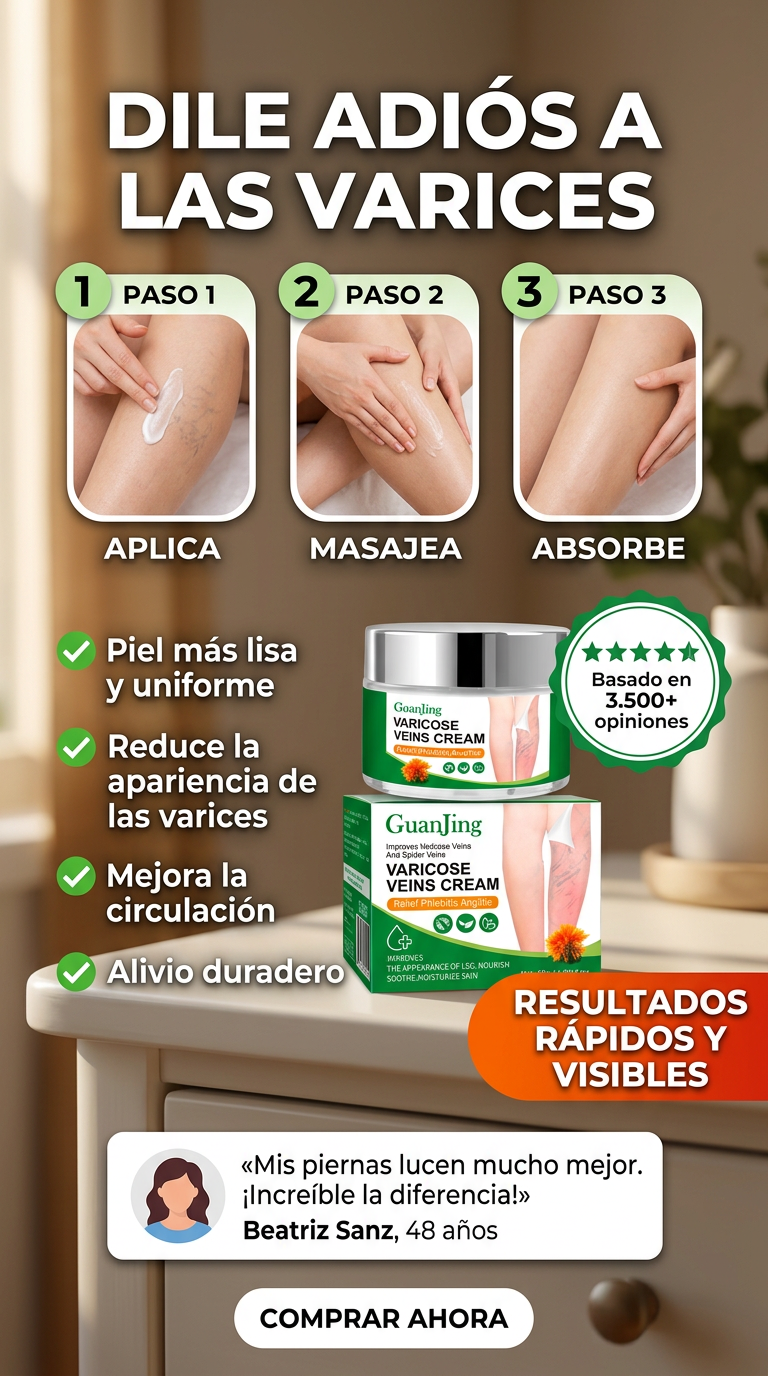 Varices: Descubre el Secreto para Piernas Perfectas