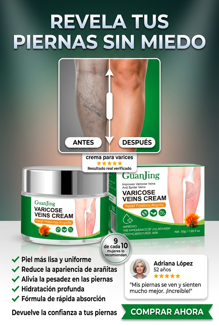 Alivia y mejora la apariencia de tus varices